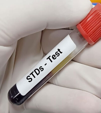 STD-7 Assessment